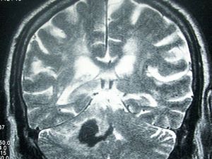 MRI-300x250.jpg