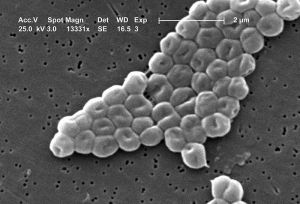 800px-Acinetobacter_baumannii.JPG
