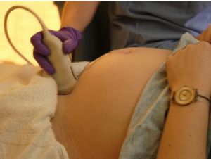 ultrasound tech