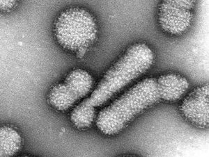 virus