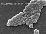 800px-Acinetobacter_baumannii.JPG