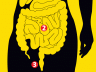 bacteria map human body