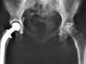 hipxray300x200.jpg