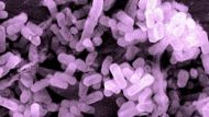 A strain of Lactobacillus plantarum (with false color)